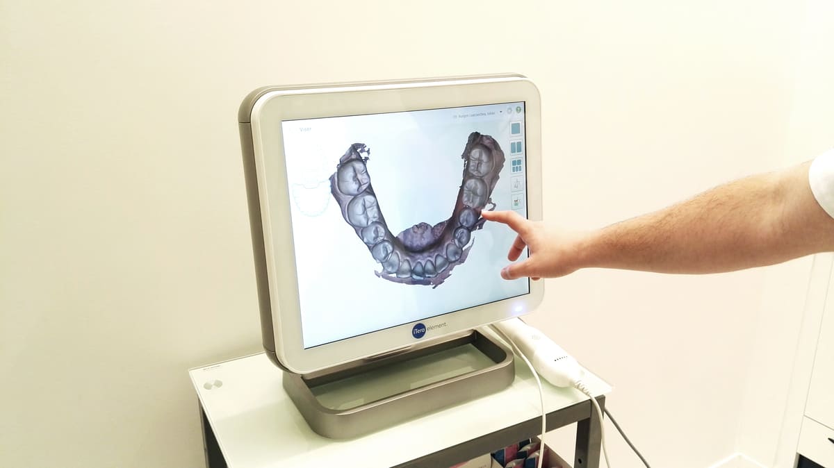 Equipo de diagnóstico 3D de la clínica para planificar implantes