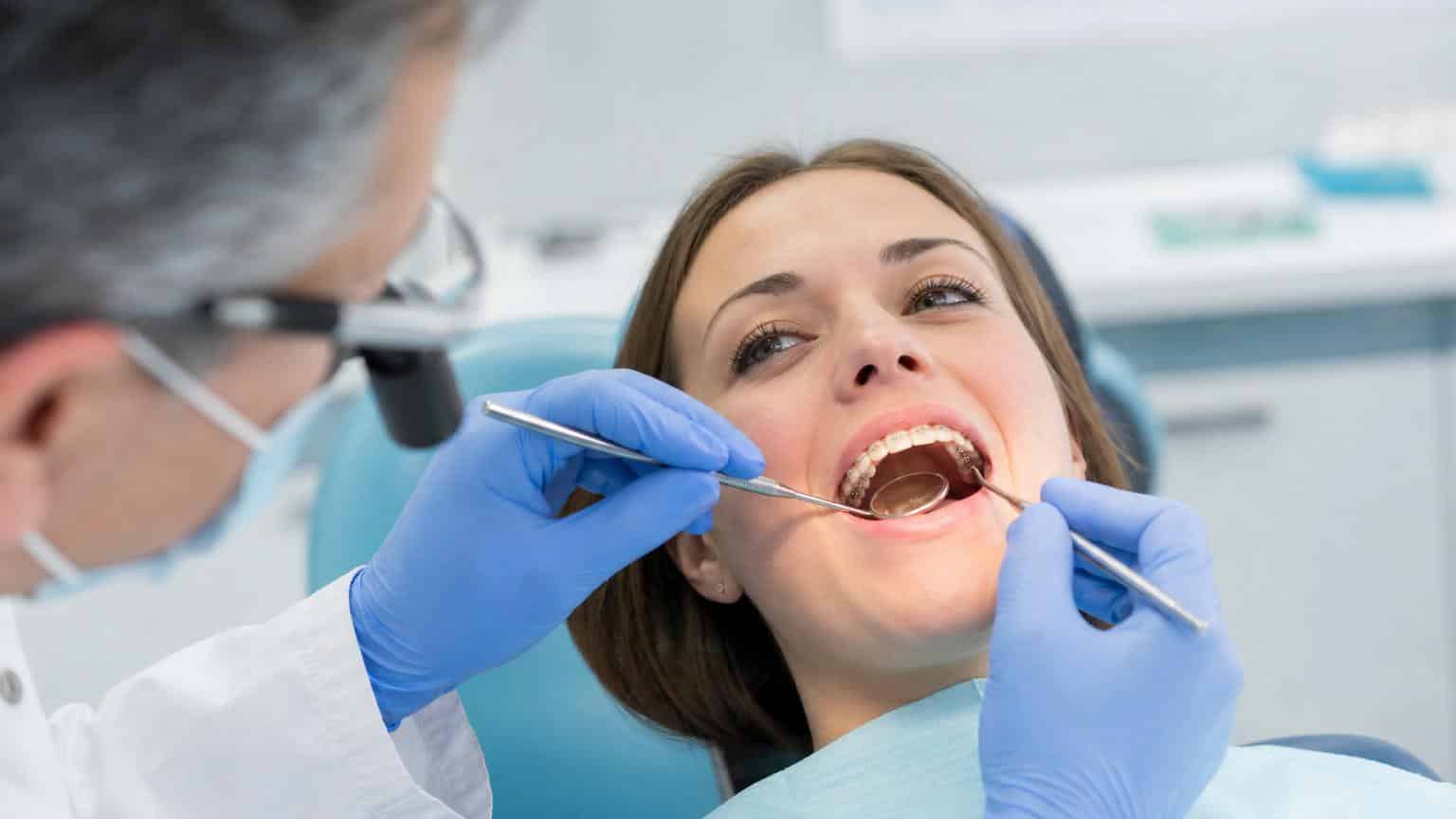 Brackets linguales: todo lo que debes saber