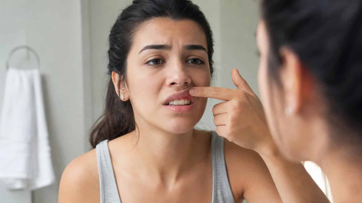Cómo bajar la inflamación de las encías