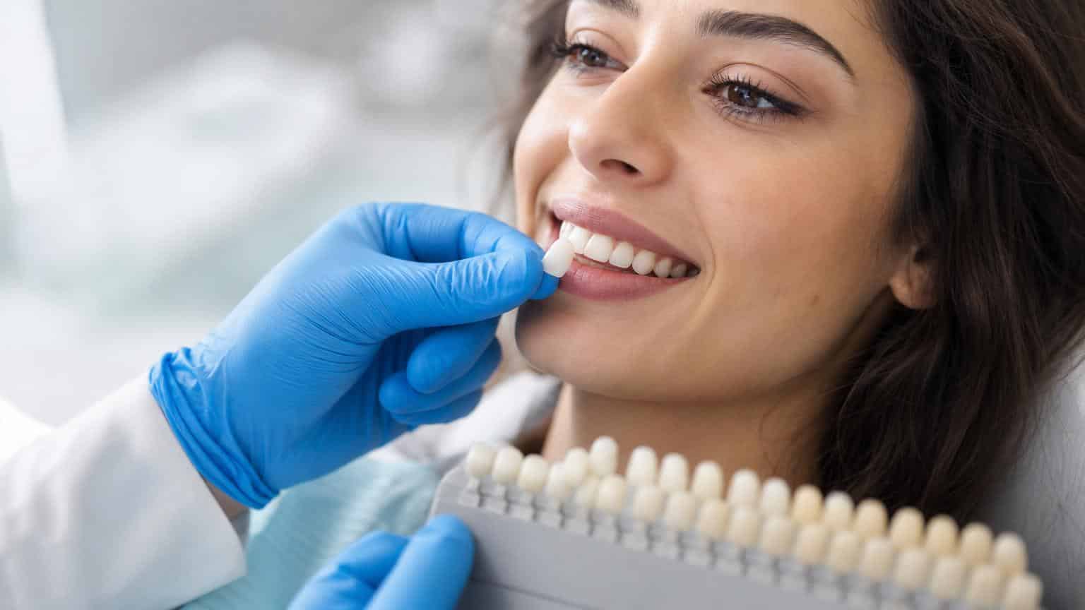 Dentist in blue gloves matching a resin veneer shade to a smiling woman's natural teeth using a dental color guide.