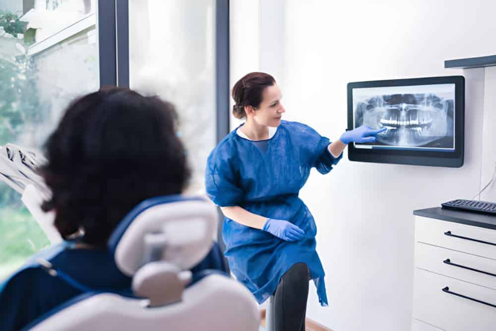 Beneficios de los implantes cigomáticos