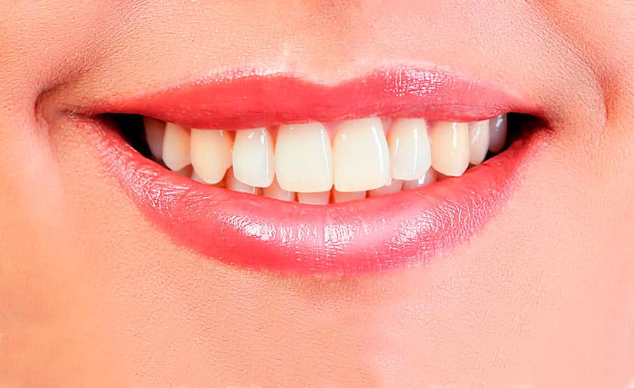 Descubre nuestros tratamientos de estética dental: antes del tratamiento