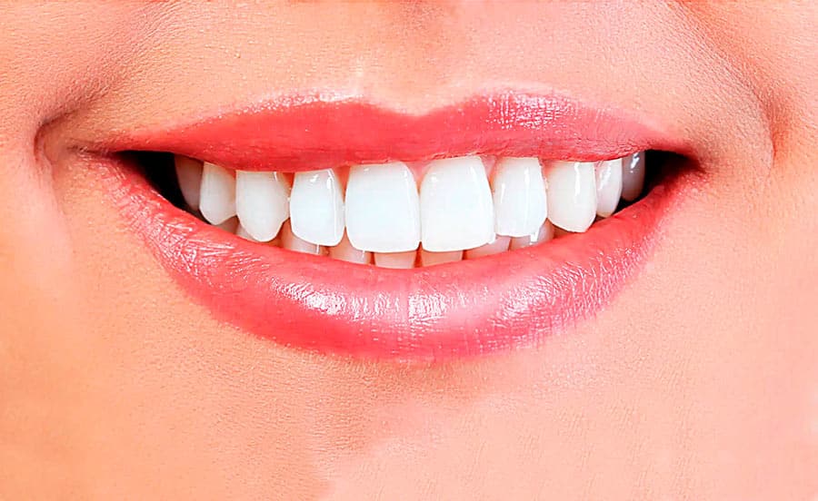 Descubre nuestros tratamientos de estética dental: después del tratamiento
