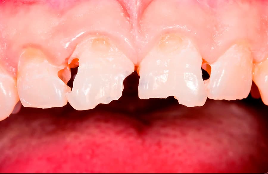 Te ayudamos a mejorar la apariencia de tu sonrisa: antes del tratamiento