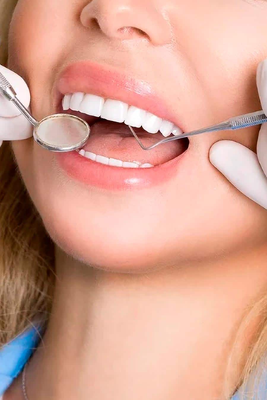 carillas dentales cerca de ti