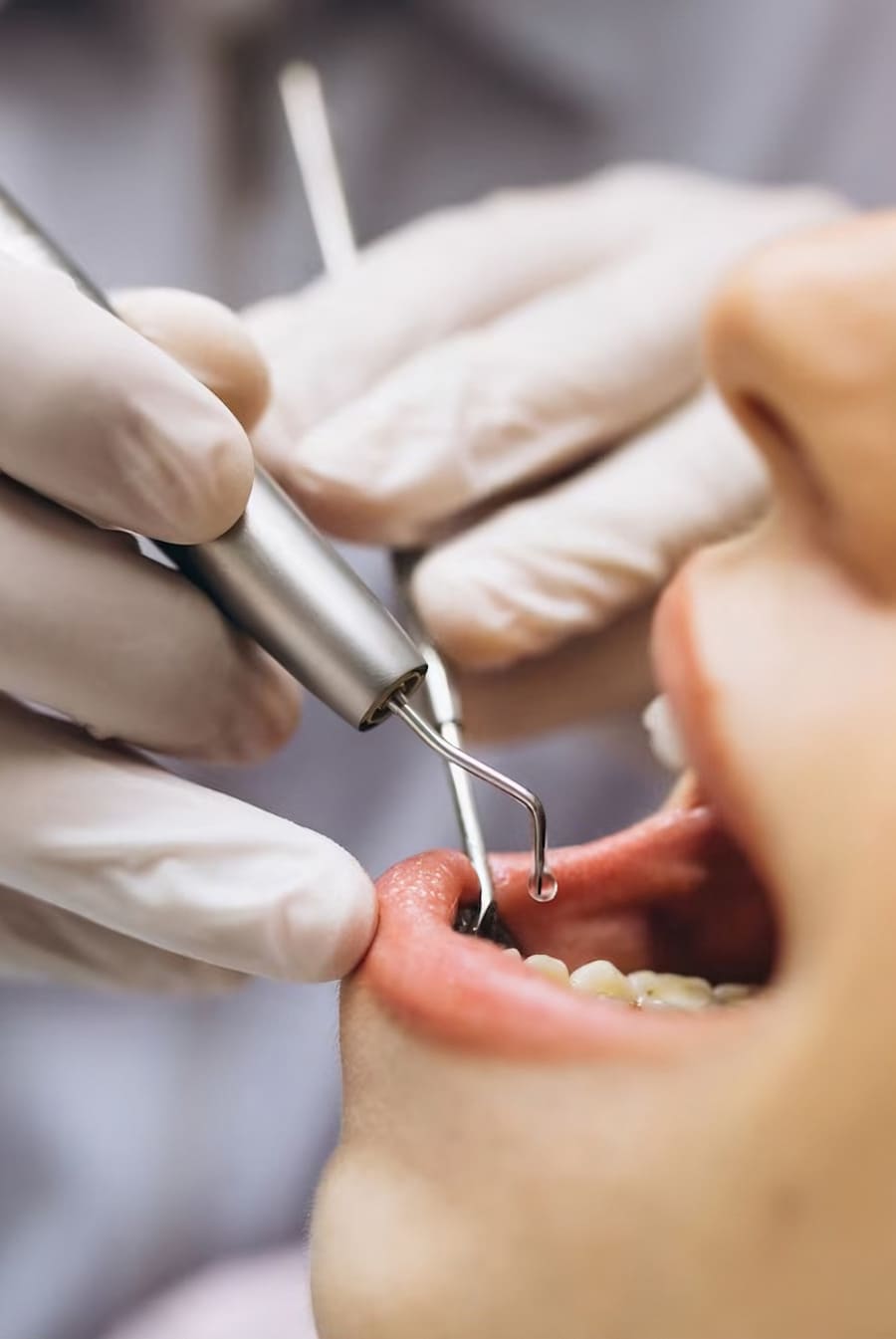 Cirugía dental Donostia
