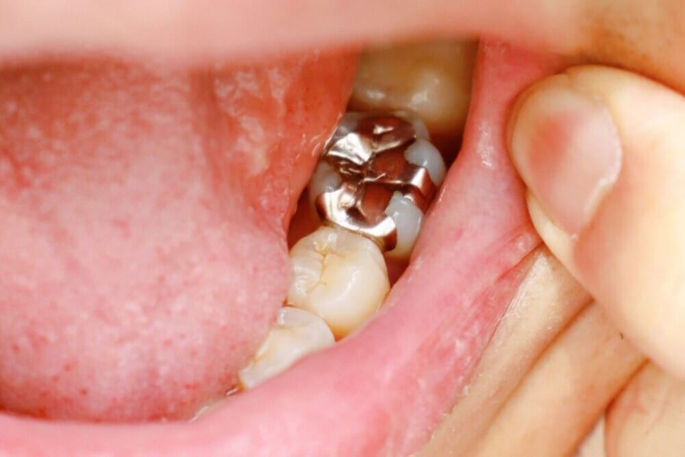 mostrando nuevo empaste dental