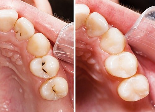 odontología general Donostia precio