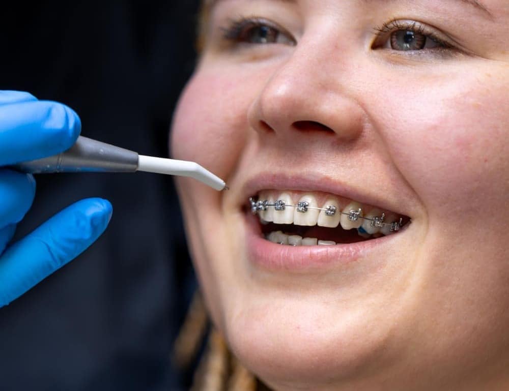 paciente sonriendo con brackets mientras recibe tratamiento dental