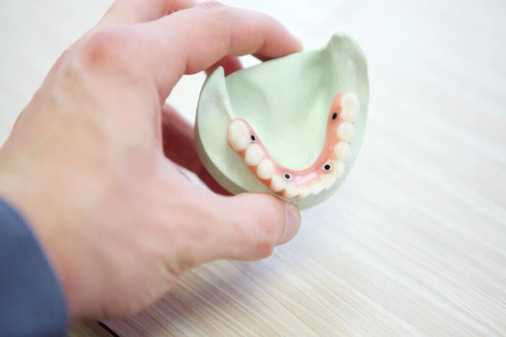 ¿Qué tipos de prótesis dentales existen?