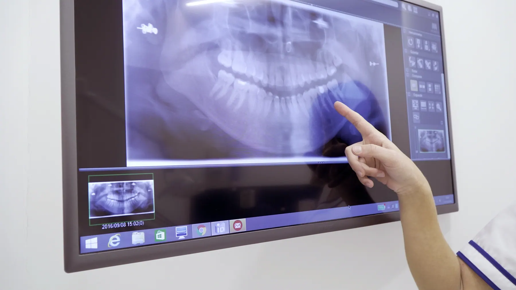 Radiografía panorámica en pantalla durante una consulta